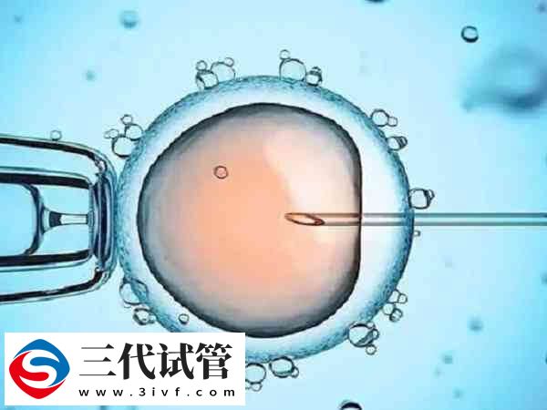 上海國(guó)婦嬰三代試管嬰兒成功率：PGD和PGS妊娠率近50%(圖1)