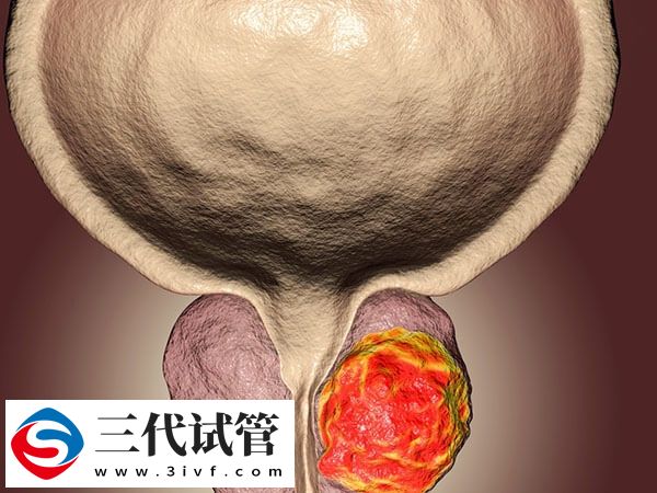 男性無法生育表現(xiàn)不止精液少，生殖器癢、肥胖也要重視(圖1)
