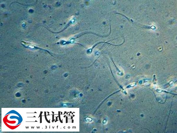 無精癥的男人怎么生孩子(圖1)