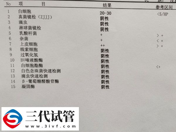 白帶常規(guī)有哪些檢查項目(圖1)