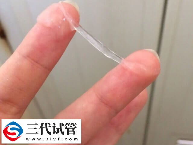 白帶常規(guī)有哪些檢查項目(圖2)