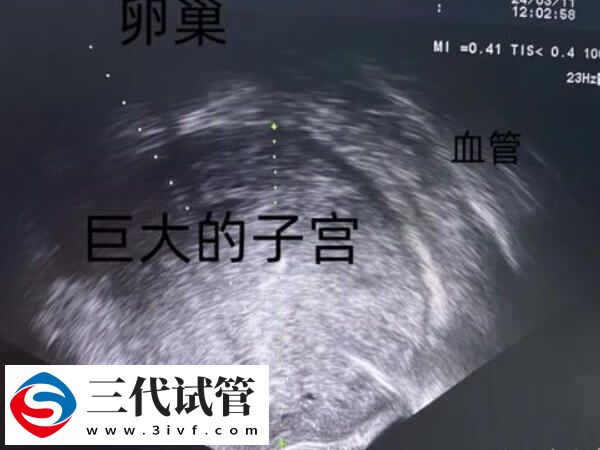為什么41歲女人做試管嬰兒會失敗？背后真相大揭秘(圖2)