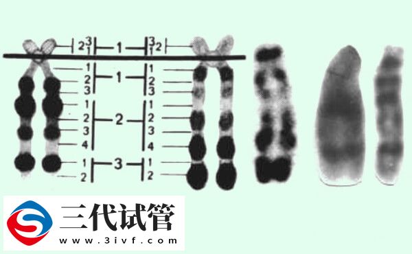 14號(hào)染色體異常能不能做三代試管(圖1)