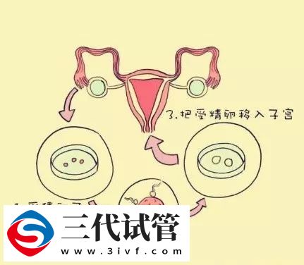 “PGD,PGS,PGT”傻傻分不清(圖2) “PGD,PGS,PGT”傻傻分不清(圖2)