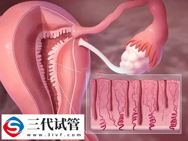 凍胚移植前做宮腔灌注有什么作用(圖1)