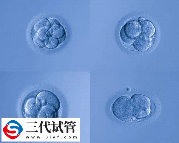 為什么囊胚培養(yǎng)會(huì)失敗(圖1)