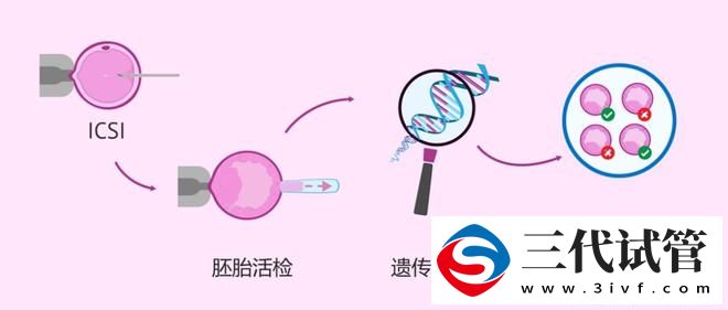 生育?阻力有哪些？為什么要用三代試管嬰兒孕育下一代？(圖3)