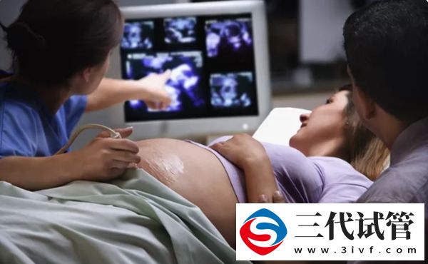 HCG值多少是懷孕了(圖3)