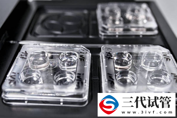 試管嬰兒胚胎移植數(shù)量是多少？科學(xué)選擇，安心好孕！(圖2)