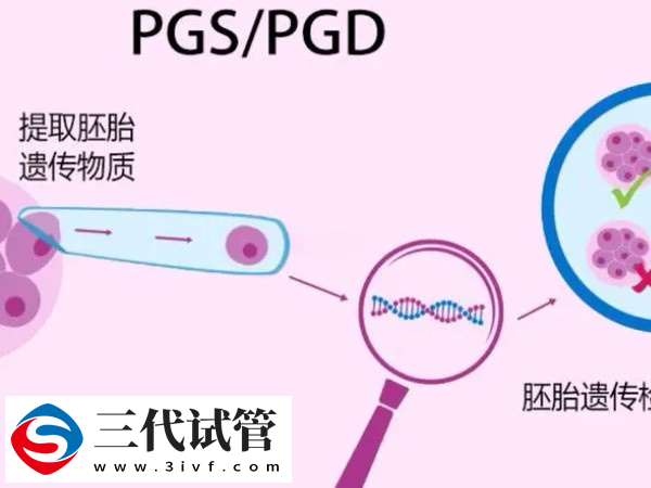 胚胎沒過pgs篩查能用不(圖1)