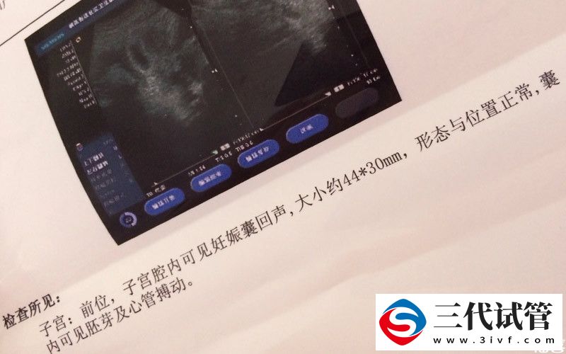 長(zhǎng)孕囊和圓孕囊的區(qū)別不止在表面！發(fā)育好壞不可相提并論(圖3)