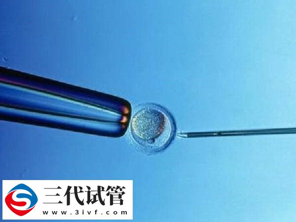 試管移植雙胎著床后能不能減胎(圖1)