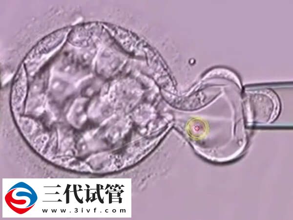 第三代試管嬰兒活檢D3胚胎有什么風險？(圖1)