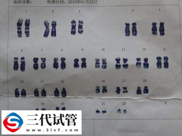 染色體47xxx可以做三代試管生孩子嗎？(圖1)