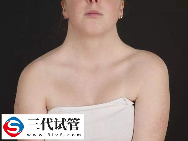自然懷孕兩次胎停都是特納要做三代嗎？(圖1)