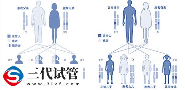 VHL綜合征遺傳給女兒的幾率大嗎？(圖1)