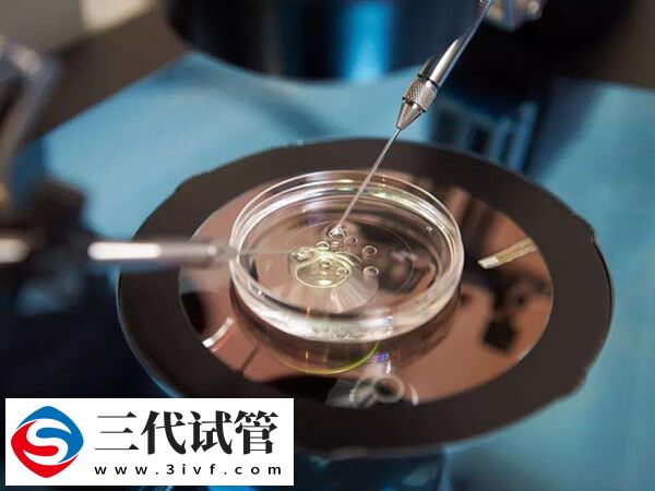 第三代試管pgt篩查后會(huì)有唐氏寶寶嗎？(圖1)