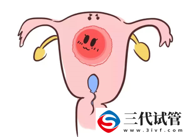 三代試管移植鮮胚2個(gè)一個(gè)流產(chǎn)一個(gè)著床(圖2)