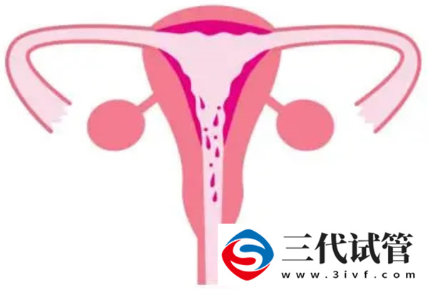 多囊試管長方案成功率高嗎，多囊患者試管3種方案成功率解讀(圖1)